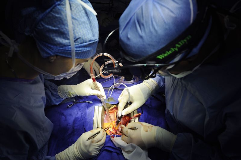 Subsidized Heart  surgeries  at UGMC
